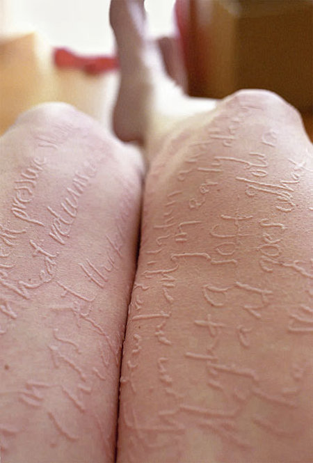 Writing in skin